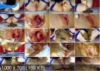  Anna Coprofield - Shit and Blood Vol.8 Speculum [2019 / FullHD]